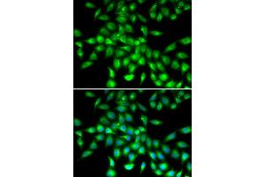 Immunofluorescence analysis of A549 cells using SERPINA10 antibody (ABIN6292722). (SERPINA10 anticorps)