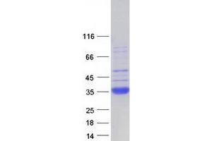Validation with Western Blot (SFTPA2 Protein (Myc-DYKDDDDK Tag))