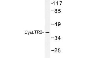 Image no. 1 for anti-Cysteinyl Leukotriene Receptor 2 (CYSLTR2) antibody (ABIN317732)