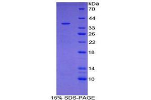 SDS-PAGE (SDS) image for Ubiquitin Carboxyl-terminal Hydrolase L5 (UCHL5) (AA 2-316) protein (His tag) (ABIN1879278)