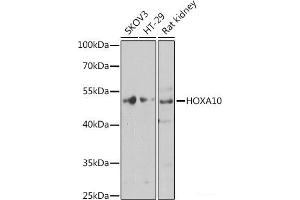 Western blot analysis of extracts of various cell lines using HOXA10 Polyclonal Antibody at dilution of 1:1000. (HOXA10 anticorps)