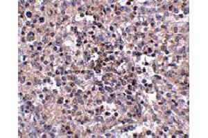 Immunohistochemistry of SLC39A10 in human spleen tissue with SLC39A10 polyclonal antibody  at 2. (SLC39A10 anticorps  (Internal Region))