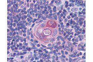 Anti-PYCARD antibody IHC of human thymus. (PYCARD anticorps  (AA 31-46))