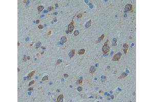 Used in DAB staining on fromalin fixed paraffin- embedded brain tissue