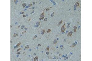 Used in DAB staining on fromalin fixed paraffin- embedded brain tissue (CNTNAP5 anticorps  (AA 25-302))