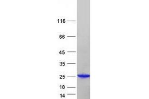 Validation with Western Blot
