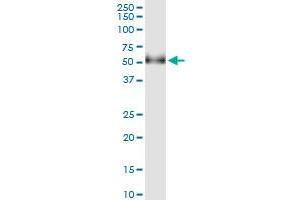 Immunoprecipitation of GAK transfected lysate using anti-GAK MaxPab rabbit polyclonal antibody and Protein A Magnetic Bead , and immunoblotted with GAK purified MaxPab mouse polyclonal antibody (B01P) .