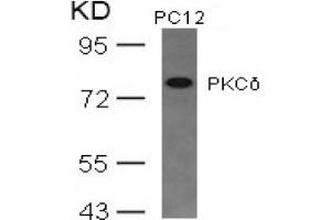 Image no. 3 for anti-Protein Kinase C, delta (PKCd) (AA 643-647) antibody (ABIN197565) (PKC delta anticorps  (AA 643-647))