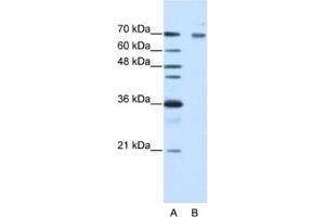 Western Blotting (WB) image for anti-Frizzled Family Receptor 7 (FZD7) antibody (ABIN2462375) (FZD7 anticorps)