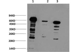 Western Blotting (WB) image for anti-Ubiquitin (Ubiquitin) antibody (ABIN5958540) (Ubiquitin anticorps)