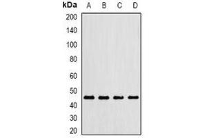 Western blot analysis of Gastric Lipase expression in MCF7 (A), mouse lung (B), mouse liver (C), rat kidney (D) whole cell lysates. (LIPF anticorps)