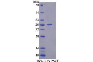 SDS-PAGE analysis of Rat IL17D Protein. (IL17D Protéine)