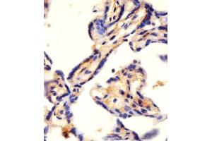 Antibody staining CAD in human placenta tissue sections by Immunohistochemistry (IHC-P - paraformaldehyde-fixed, paraffin-embedded sections). (CAD anticorps  (AA 780-809))