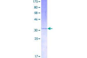 Image no. 1 for Chemokine (C-X-C Motif) Ligand 3 (CXCL3) (AA 1-107) protein (GST tag) (ABIN1350824)