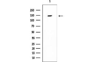 Western blot analysis of lysates from Mouse brain, using MAP4K4 Mouse Monoclonal Antibody at 1/1000 dilution.