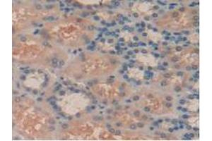 IHC-P analysis of Human Kidney Tissue, with DAB staining. (SYK anticorps  (AA 374-635))