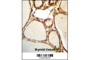 HJURP Antibody immunohistochemistry analysis in formalin fixed and paraffin embedded human thyroid tissue followed by peroxidase conjugation of the secondary antibody and DAB staining.