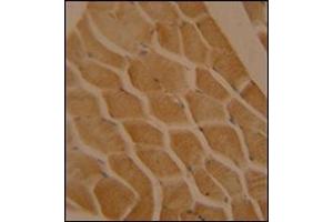 Immunohistochemistry analysis in formalin fixed and paraffin embedded human skeletal muscle reacted with LMOD2 Antibody (N-term) followed which was peroxidase conjugated to the secondary antibody and followed by DAB staining.