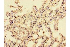 Immunohistochemistry of paraffin-embedded human lung tissue using ABIN7161758 at dilution of 1:100