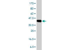 Western Blot detection against Immunogen (38. (RASGRP3 anticorps  (AA 581-690))