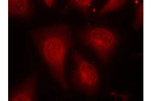 Immunofluorescence staining of methanol-fixed Hela cells using HDAC8(Phospho-Ser39) Antibody. (HDAC8 anticorps  (pSer39))
