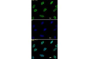 Histone H3 dimethyl Lys9 antibody tested by immunofluorescence. (Histone 3 anticorps  (2meLys9))