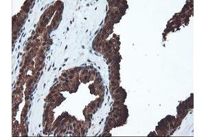 Image no. 9 for anti-Proteasome Subunit alpha 6 (PSMA6) antibody (ABIN1500465)