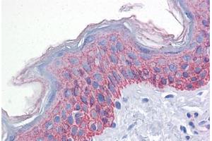 Anti-BUB1B / BubR1 antibody IHC staining of human skin.