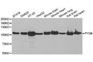 Western blot analysis of extracts of various cell lines, using PYGB antibody.