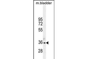 TGIF1 Antibody (Center ) (ABIN655999 and ABIN2845378) western blot analysis in mouse bladder tissue lysates (35 μg/lane). (TGIF1 anticorps  (AA 208-237))