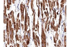 ABIN6266853 at 1/100 staining human Heart muscle tissue sections by IHC-P. (Transglutaminase 2 anticorps  (N-Term))