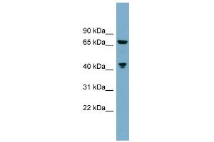 WB Suggested Anti-GLS Antibody Titration: 0.