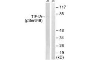 Western blot analysis of extracts from Jurkat cells treated with starved 24h, using TIF-IA (Phospho-Ser649) Antibody.