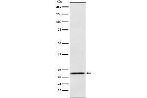 Western blot analysis of Prolactin expression in Human fetal pituitary lysate.