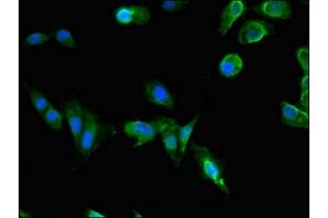 Immunofluorescent analysis of Hela cells using ABIN7163601 at dilution of 1:100 and Alexa Fluor 488-congugated AffiniPure Goat Anti-Rabbit IgG(H+L) (PAFAH1B1 anticorps  (AA 40-155))