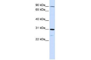 LONRF3 antibody used at 1 ug/ml to detect target protein. (LONRF3 anticorps  (N-Term))