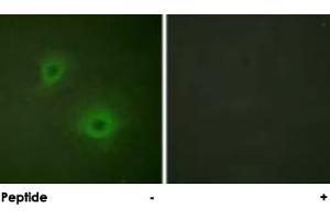 Immunofluorescence analysis of HUVEC cells, using EPHB1/EPHA2 polyclonal antibody . (EPH Receptor B1 anticorps)