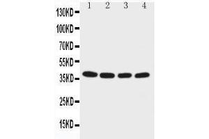 Anti-EIF2S2 antibody, Western blotting Lane 1: M451 Cell Lysate Lane 2: JURKAT Cell Lysate Lane 3: HELA Cell Lysate Lane 4:293T Cell Lysate (EIF2S2 anticorps  (C-Term))