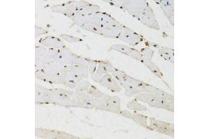 Immunohistochemistry of paraffin-embedded mouse heart using BAZ1B antibody (ABIN6003583) at dilution of 1/100 (40x lens). (BAZ1B anticorps)