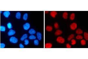 Immunofluorescence analysis of 293T cells using MonoMethyl-Histone H3-K27 Polyclonal Antibody (Histone 3 anticorps  (meLys27))
