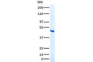 Validation with Western Blot (SERPINB2 Protein (Transcript Variant 2))