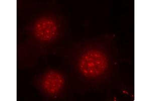 Immunofluorescence staining of methanol-fixed MCF-7 cells using Phospho-FOXO4-S197 antibody (ABIN2987524). (FOXO4 anticorps  (pSer197))