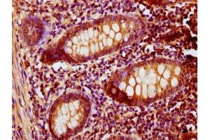 IHC image of ABIN7146432 diluted at 1:200 and staining in paraffin-embedded human appendix tissue performed on a Leica BondTM system.