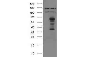 Image no. 1 for anti-SUMO1/sentrin/SMT3 Specific Peptidase 2 (SENP2) (AA 139-523) antibody (ABIN1490928) (SENP2 anticorps  (AA 139-523))