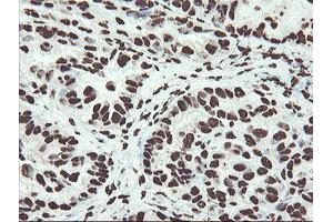 anti-Non-POU Domain Containing, Octamer-Binding (NONO) (AA 184-385) antibody