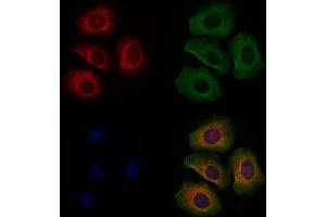 ABIN6261629 and ABIN6278037 staining Hela cells by IF/ICC. (EYA2 anticorps  (Internal Region))