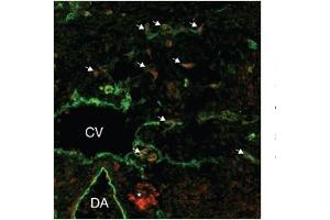 lymphatic endothelial cell tissue and primary (1/50 up to 1/500) secondary 1/200