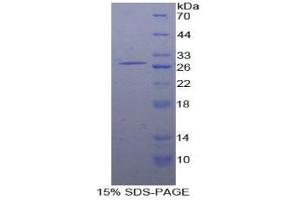 SDS-PAGE analysis of Human SLAMF5 Protein. (Signaling Lymphocytic Activation Molecule Family, Member 5 Protéine)