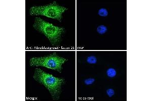 (ABIN238569) Immunofluorescence analysis of paraformaldehyde fixed HeLa cells, permeabilized with 0.