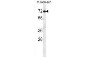Western Blotting (WB) image for anti-Activating Transcription Factor 7 Interacting Protein 2 (ATF7IP2) antibody (ABIN2995682) (ATF7IP2 anticorps)